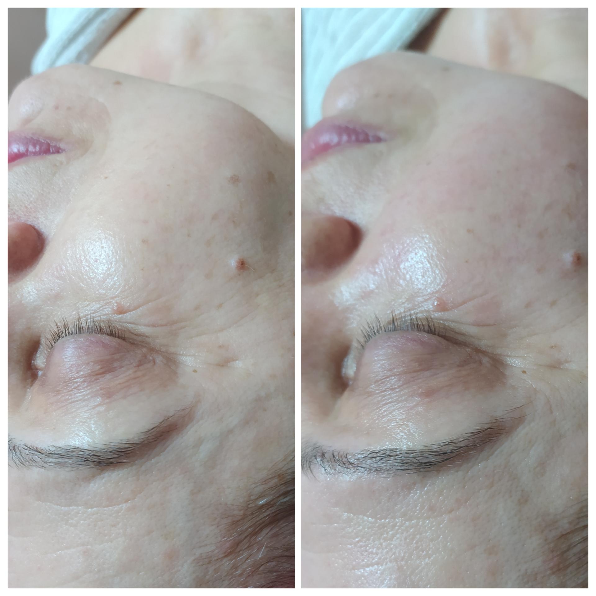 Массаж лица и задней поверхности шеи