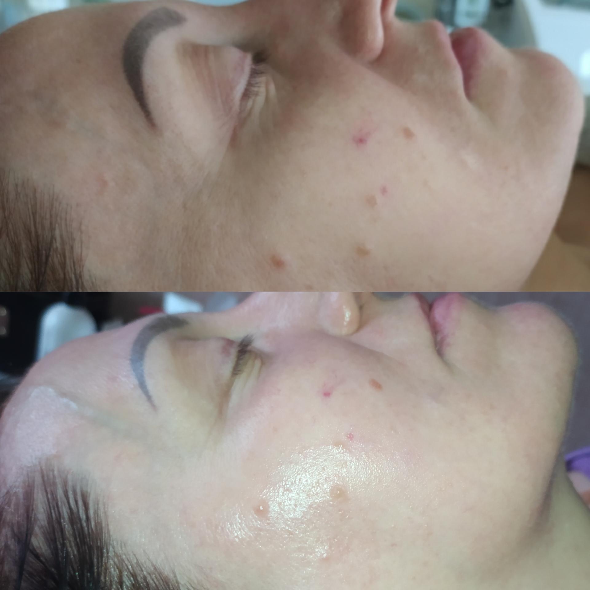 Массаж лица и задней поверхности шеи